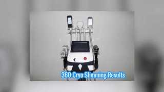 360° View Cryo Slimming Device