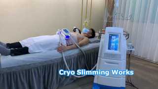 Cryo Slimming Actual Working Scene
