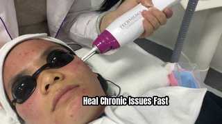 Spots removal treatment video BGM68