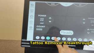 2 in 1 diode laser and q-switch tattoo removal machine video